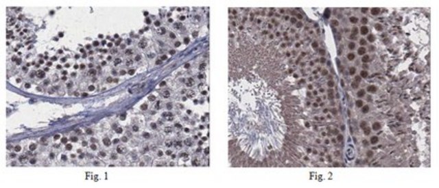 Anti-Goosecoid 2 Antibody from rabbit, purified by affinity chromatography