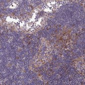 Anti-COL8A2 antibody produced in rabbit Prestige Antibodies® Powered by Atlas Antibodies, affinity isolated antibody, buffered aqueous glycerol solution