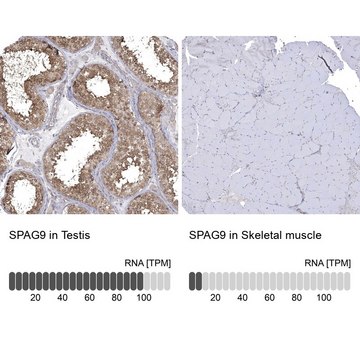 Anti-SPAG9 antibody produced in rabbit Prestige Antibodies&#174; Powered by Atlas Antibodies, affinity isolated antibody, buffered aqueous glycerol solution