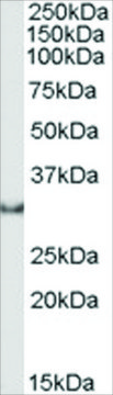 Anti-Osteopontin/SPP1 antibody produced in goat affinity isolated antibody, buffered aqueous solution