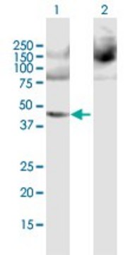 Anti-PPME1 antibody produced in mouse purified immunoglobulin, buffered aqueous solution