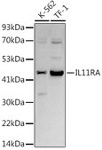 Anti-IL11RA Antibody, clone 10Z3S9, Rabbit Monoclonal