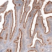 Monoclonal Anti-Msln Antibody Produced In Mouse Prestige Antibodies® Powered by Atlas Antibodies, clone CL13957, affinity isolated antibody, buffered aqueous glycerol solution