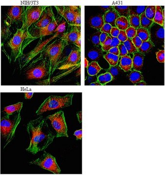 Anti-LAMP-1 (CD107a) Antibody from rabbit, purified by affinity chromatography