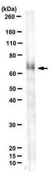 Anti-P40 (TP63) Antibody, clone 11H1 clone 11H1, from mouse