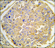 Anti-DKK2 (C-term) antibody produced in rabbit IgG fraction of antiserum, buffered aqueous solution
