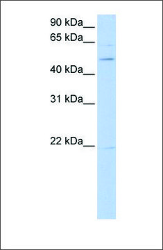 Anti-RORB antibody produced in rabbit affinity isolated antibody