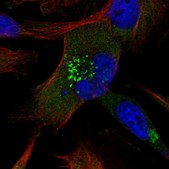 Anti-ABCB6 antibody produced in rabbit Prestige Antibodies® Powered by Atlas Antibodies, affinity isolated antibody, buffered aqueous glycerol solution