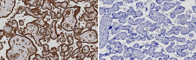 抗-GLUT-1抗体，CT from rabbit, purified by affinity chromatography