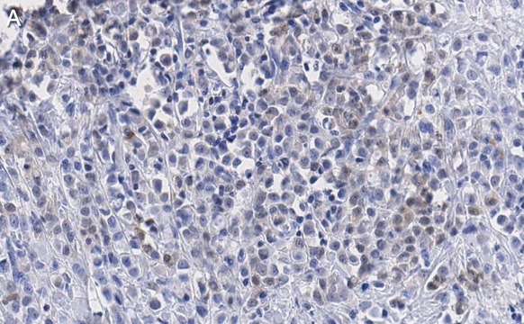 Anti-SSNA1 Antibody, clone 4C4 ZooMAb&#174; Rabbit Monoclonal recombinant, expressed in HEK 293 cells