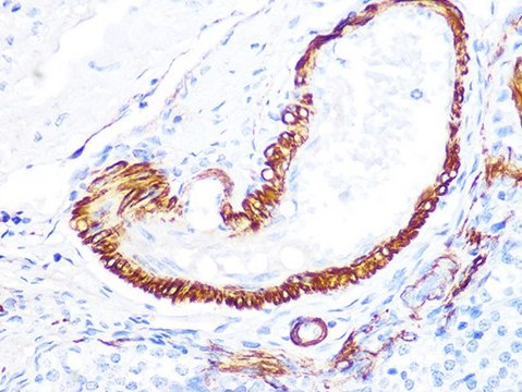 Anti-LDHB antibody produced in rabbit