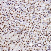Anti-GTF2F2 Antibody, clone 3T7Q9, Rabbit Monoclonal