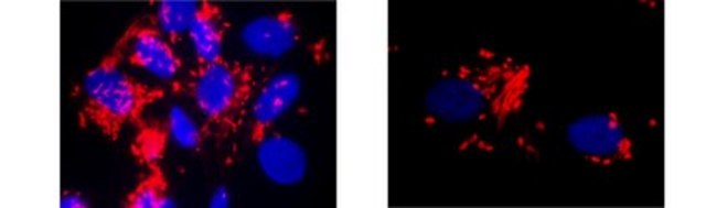 Anti-von Willebrand factor (vWF) Antibody, clone IIIE2.34 clone IIIE2.34, from mouse