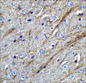 Anti-TWEAK antibody produced in rabbit purified immunoglobulin, buffered aqueous solution