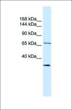 Anti-SEMA6D antibody produced in rabbit affinity isolated antibody