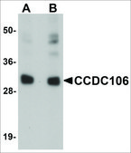 Anti-CCDC106 antibody produced in rabbit affinity isolated antibody, buffered aqueous solution