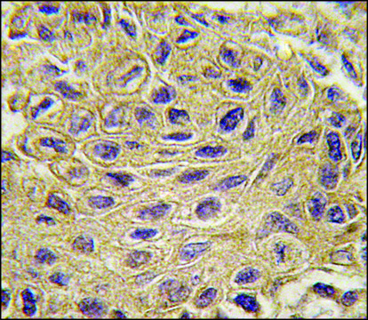 Anti-CTGF (center) antibody produced in rabbit saturated ammonium sulfate (SAS) precipitated, buffered aqueous solution