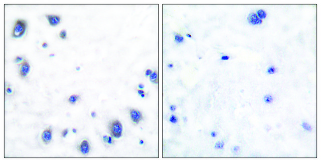 Anti-Tyrosine Hydroxylase, N-Terminal antibody produced in rabbit affinity isolated antibody