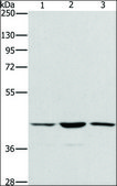 Anti-IBSP antibody produced in rabbit affinity isolated antibody