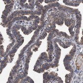 Anti-ITIH3 antibody produced in rabbit Prestige Antibodies® Powered by Atlas Antibodies, affinity isolated antibody, buffered aqueous glycerol solution
