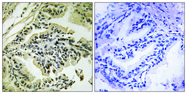 Anti-phospho-PEK/PERK (pThr981) antibody produced in rabbit affinity isolated antibody