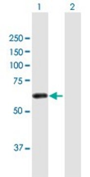 Anti-ZSCAN21 antibody produced in mouse purified immunoglobulin, buffered aqueous solution