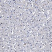 Anti-SLC43A2 antibody produced in rabbit Prestige Antibodies® Powered by Atlas Antibodies, affinity isolated antibody, buffered aqueous glycerol solution