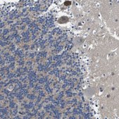 Anti-SCN4B antibody produced in rabbit Prestige Antibodies® Powered by Atlas Antibodies, affinity isolated antibody, buffered aqueous glycerol solution