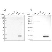 Anti-RIDA antibody produced in rabbit Prestige Antibodies® Powered by Atlas Antibodies, affinity isolated antibody, buffered aqueous glycerol solution, Ab1