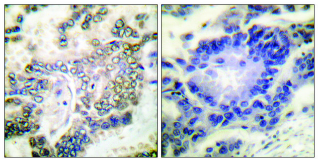 Anti-C/EBP-&#945; antibody produced in rabbit affinity isolated antibody