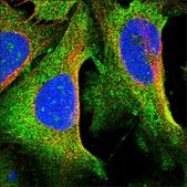 Anti-CCBE1 antibody produced in rabbit Prestige Antibodies® Powered by Atlas Antibodies, affinity isolated antibody, buffered aqueous glycerol solution