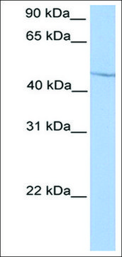 Anti-HOXA13 antibody produced in rabbit affinity isolated antibody