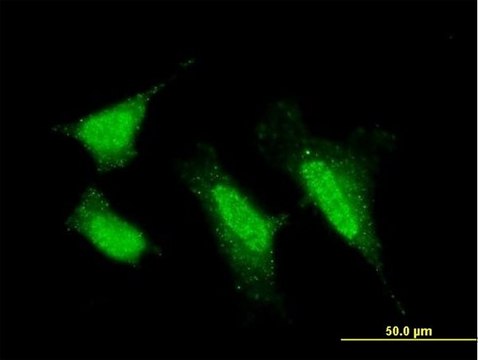 Monoclonal Anti-PRKCI antibody produced in mouse clone 1G11, purified immunoglobulin, buffered aqueous solution