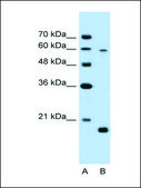 Anti-SLC38A4 antibody produced in rabbit IgG fraction of antiserum