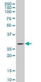 Monoclonal Anti-C1QTNF1 antibody produced in mouse clone 4A10, purified immunoglobulin, buffered aqueous solution