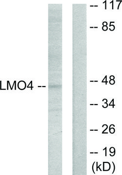 Anti-LMO4 antibody produced in rabbit affinity isolated antibody