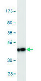 Monoclonal Anti-CEACAM6 antibody produced in mouse clone 1G2, purified immunoglobulin, buffered aqueous solution