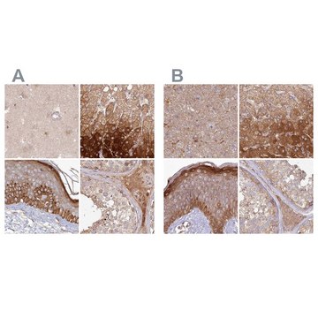 Anti-HAL antibody produced in rabbit Prestige Antibodies&#174; Powered by Atlas Antibodies, affinity isolated antibody, buffered aqueous glycerol solution