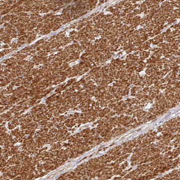 Anti-METTL22 antibody produced in rabbit Prestige Antibodies&#174; Powered by Atlas Antibodies, affinity isolated antibody, buffered aqueous glycerol solution