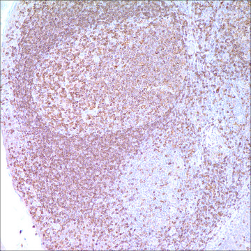 CD74 (LN2) Mouse Monoclonal Antibody