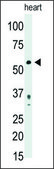 Anti-PDX1 (N-term) antibody produced in rabbit IgG fraction of antiserum, buffered aqueous solution
