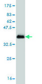 Monoclonal Anti-CSNK1G1 antibody produced in mouse clone 2E10, purified immunoglobulin, buffered aqueous solution