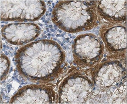 Anti-Galectin-4 Antibody from rabbit, purified by affinity chromatography