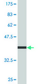 Monoclonal Anti-PSMB8, (C-terminal) antibody produced in mouse clone 1G7, purified immunoglobulin, buffered aqueous solution