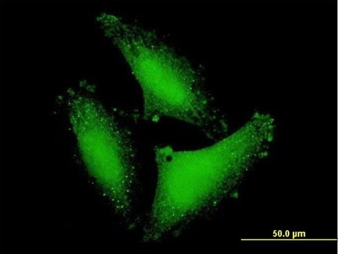 Anti-DCP2 antibody produced in mouse purified immunoglobulin, buffered aqueous solution