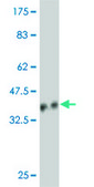 Monoclonal Anti-NDUFB5 antibody produced in mouse clone 5G5, purified immunoglobulin, buffered aqueous solution