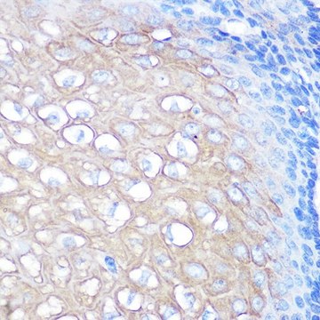 Anti- CD168/RHAMM antibody produced in rabbit