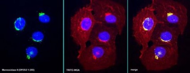 Anti-Mannosidase II Antibody, For Golgi Apparatus identification serum, Chemicon&#174;