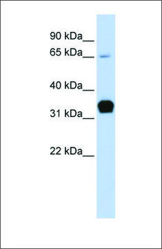 Anti-TNNT1 antibody produced in rabbit affinity isolated antibody