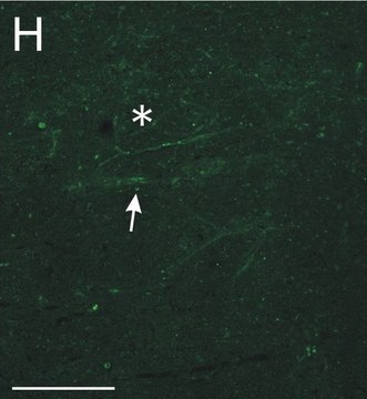 Anti-Chondroitin Sulfate Proteoglycan Antibody, Brain (core protein), clone Cat-301 clone Cat-301, Chemicon&#174;, from mouse